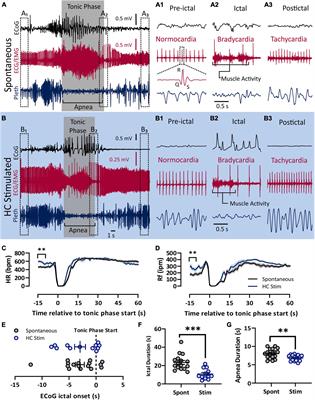 Peri-Ictal Autonomic Control of Cardiac Function and Seizure-Induced Death